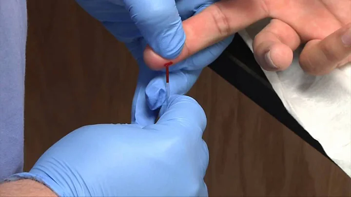 Phlebotomy: Dermal Capillary Punctures | Blood Col...