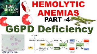 Hemolytic Anemias- Part 4: G6PD Deficiency; Pathophysiology,Morphology, clinical features