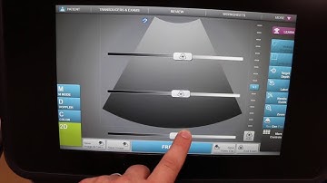 Sonosite X-porte Introduction