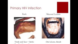 HIV for Primary Care Physicians screenshot 1