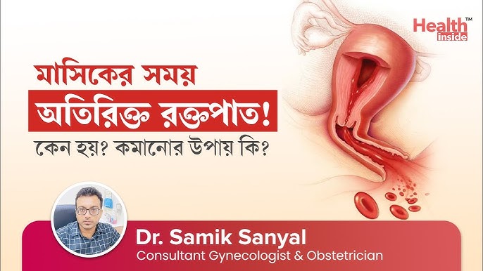 Kirovdagi fohishalar haqida forum