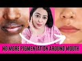 गुड़ में ये 2 चीजे मिला लेना होठों के आस पास का कालापन होगा दूर-Remove Pigmentation Around Mouth 100%