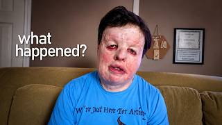 "My Brothers Set Me on Fire"  | Terry's Powerful Story