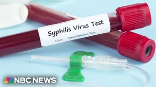 Syphilis rates in the U S up 80 since 2018