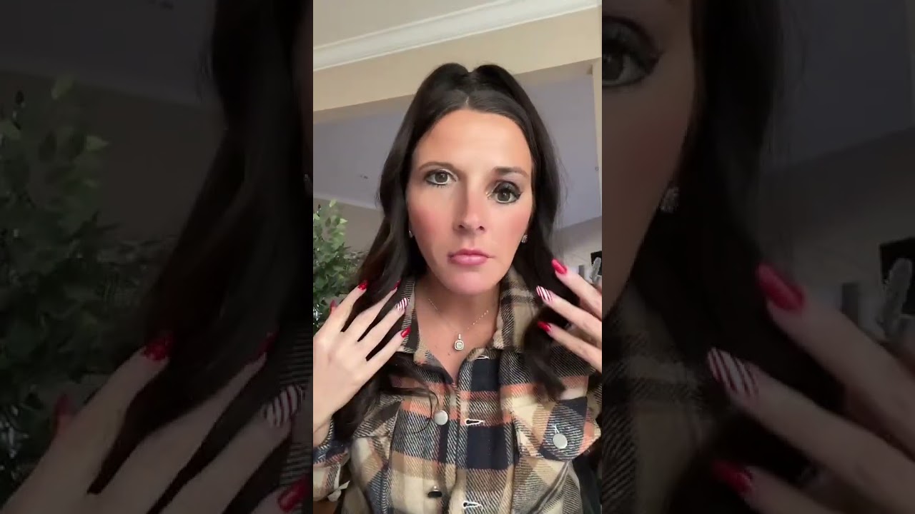 ПЕРВЫЙ И ПОСЛЕДНИЙ РАЗ КОЛОТАЮ БОТОКСА! 🤣