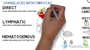Mechanisms of Cancer Spread