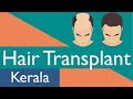 Hair Transplant in Kerala | Best cost & Best Results for hair transplant in kerala