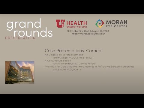Case Presentations: Cornea