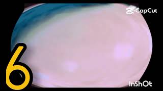 Ihate G Major 74 1 - 20 Preview 1280 Part 475