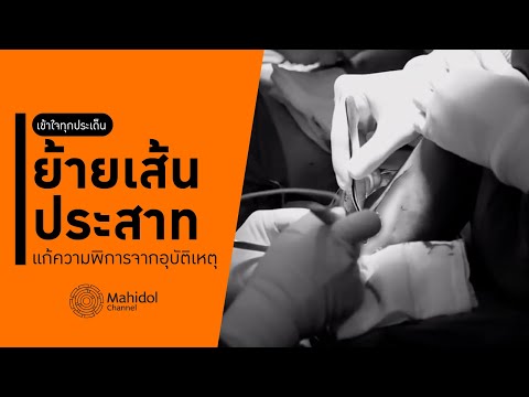 “ย้ายเส้นประสาท” แก้ความพิการจากอุบัติเหตุ [หาหมอ by Mahidol Channel]