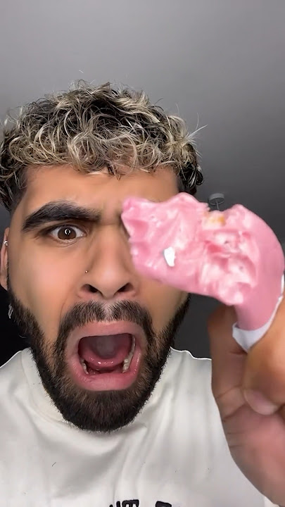 Why These Cavity Fillings DO NOT Exist Anymore! 😭🦷