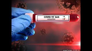 Blood type and COVID-19 risk not linked, Intermountain Healthcare researchers find