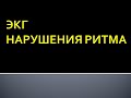 ЭКГ. Нарушения ритма сердца. Максимцева Е. А.