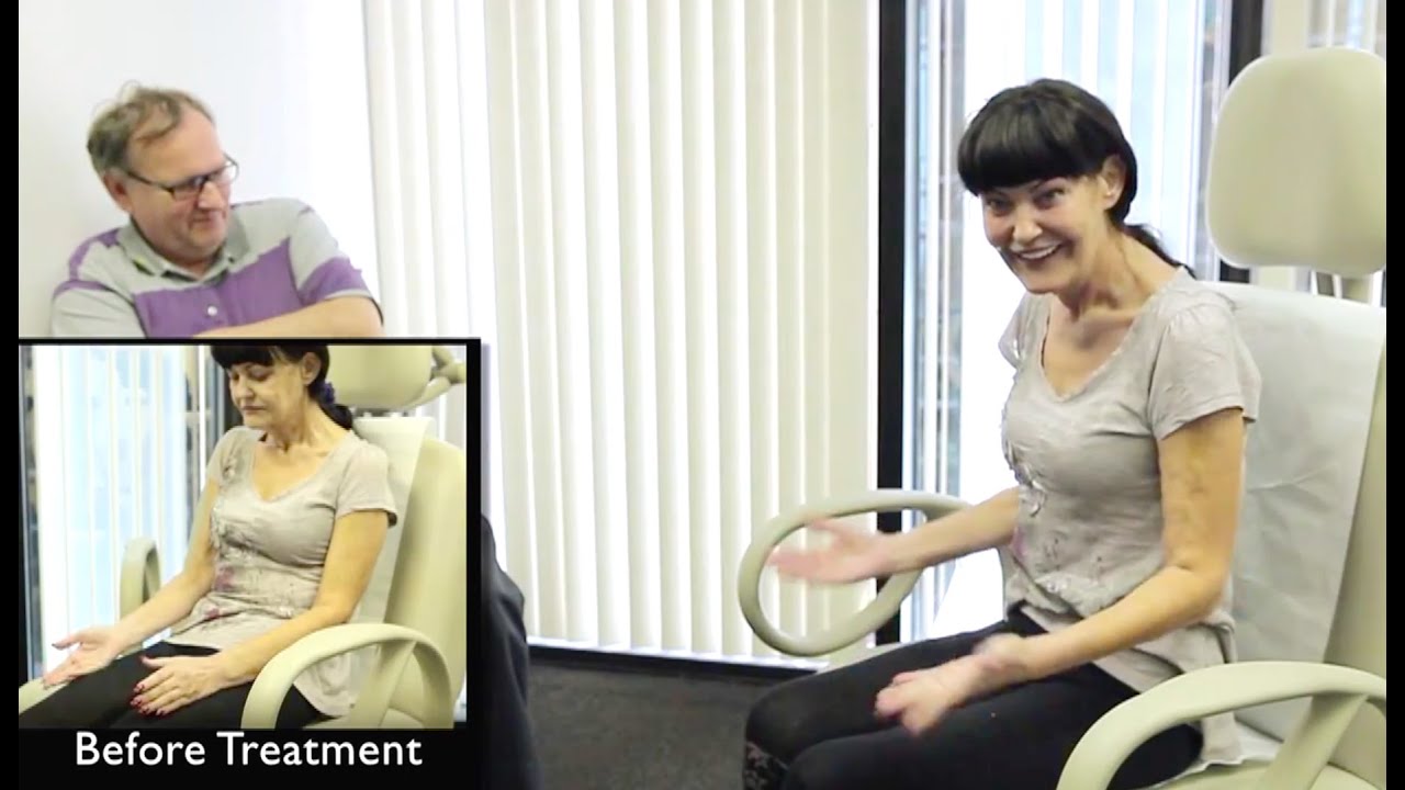 Rapid improvement in chronic post-stroke pain 3 years after stroke 720p