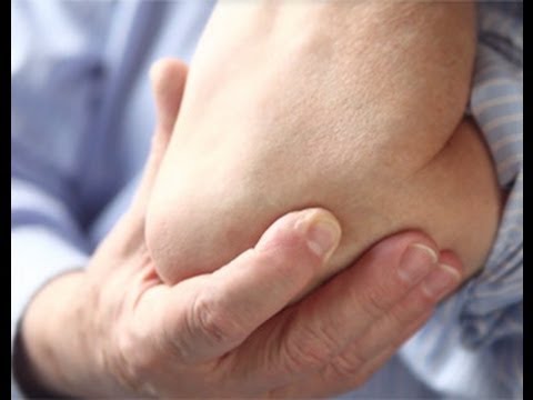 Cubital Tunnel Syndrome with Hand Surgeon Dr. Jackson Ombaba
