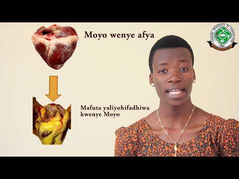 Video: Jinsi Ya Kuzuia Unene Kupita Kiasi Kwa Mtoto