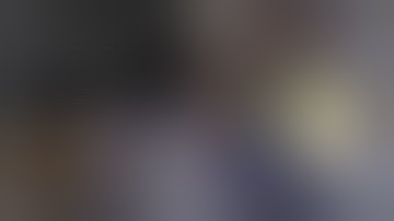 Hooks and rings to the rescue in topical Phacoemulsification of a hard cataract with small pupils.