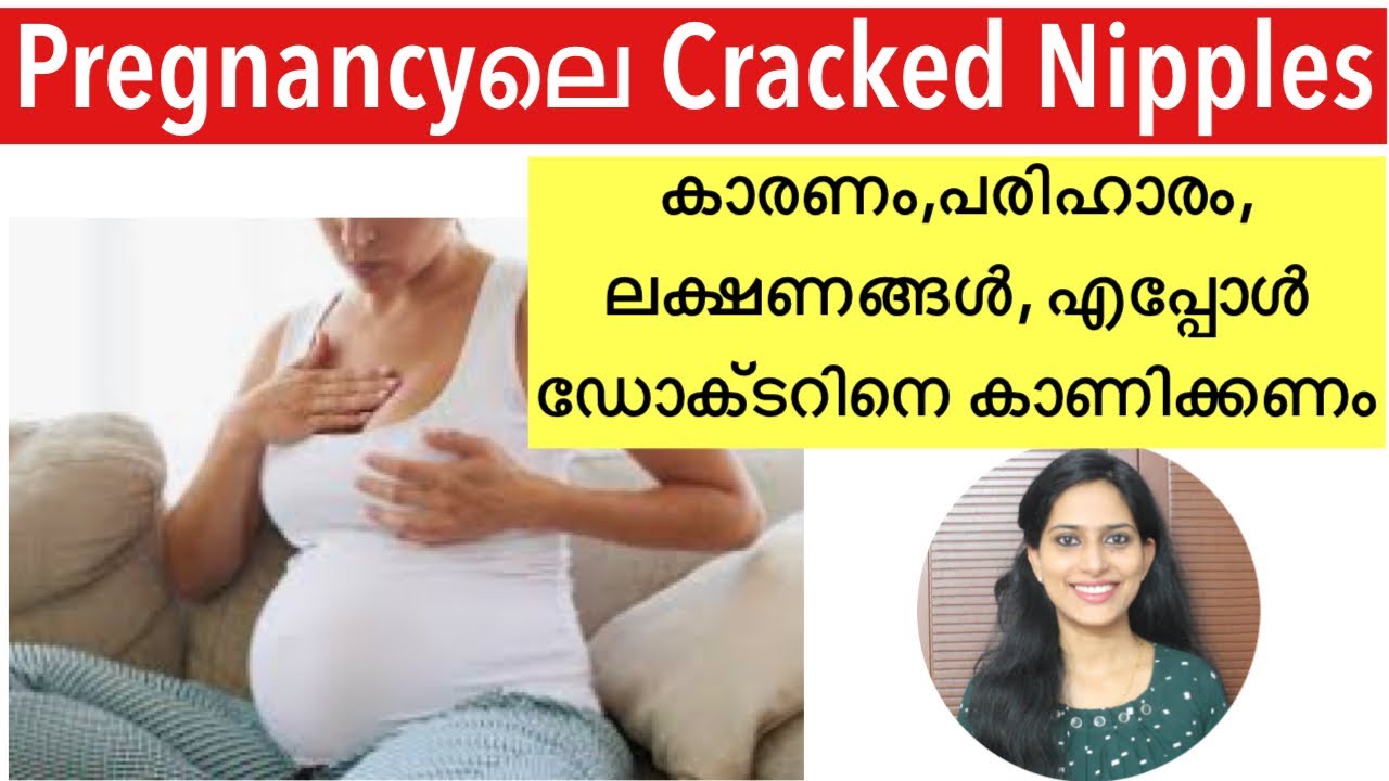 Cracked Nipples/Sore Nipples During Pregnancy Malayalam. മുലക്കണ്ണ് വിണ്ടുകീറൽ Tips & HOME