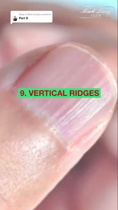 9 HEALTH WARNING SIGNS REVEALED BY LOOKING AT YOUR NAILS! #shorts