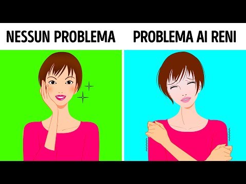 Video: Chi Sono Le Persone Ad Alta Frequenza?