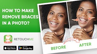 Achieve a Confident Grin with RetouchMe's Remove Braces Editing Service screenshot 4