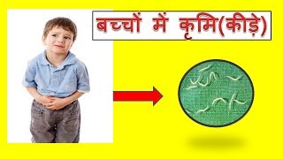 Stomach worms in kids/बच्चों में कृमि(कीड़े) screenshot 5