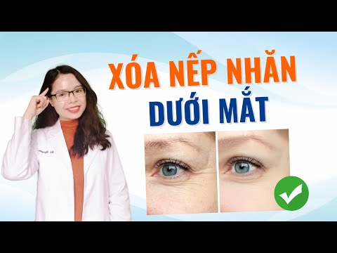 Video: 5 cách đơn giản để điều trị nếp nhăn dưới mắt