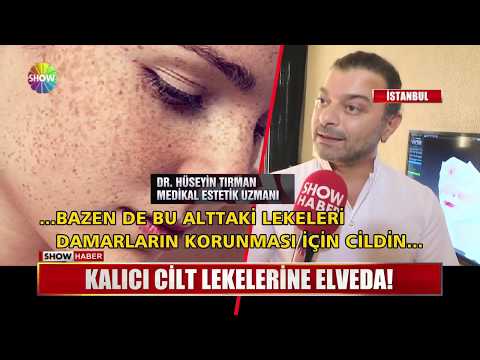 Kalıcı cilt lekelerine elveda!