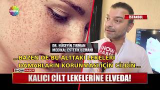 Kalıcı cilt lekelerine elveda! Resimi