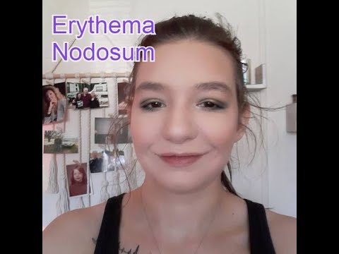 STORYTIME: Erythema Nodosum #IBDAwarenessWeek