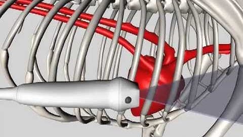 Equine Echocardiographic Technique (Cardiac Ultrasound)
