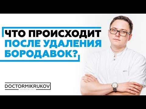 Видео: Почему сэр Эктор Кей и бородавка едут в Лондон?