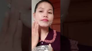 Overnight Acne Treatment | Remove Pimples & Acne Overnight #youtubeshorts #pimple #acne