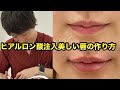 【ヒアルロン酸注入】美しい唇の作り方！お見せします！