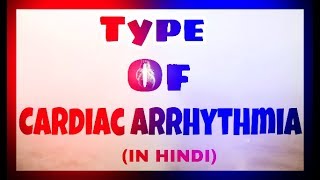 Types of Cardiac Arrhythmia | Cardiac Arrhythmia | Become Doctor Ft. Deepesh Soni