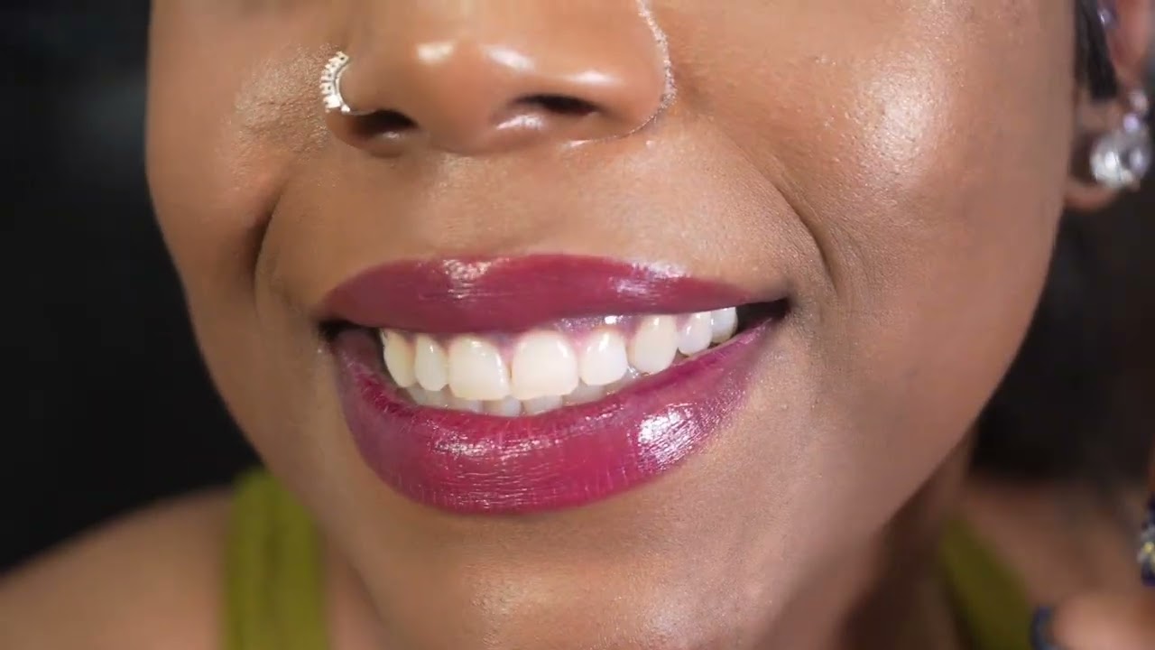 Her smile was already beautiful — but now? It’s absolutely irresistible. 😍 Thanks to Dr. Curves!