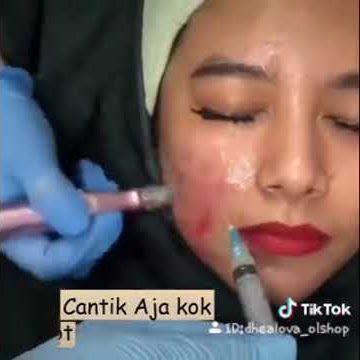 KULIT PUTIH TANPA SUNTIK CUKUP KONSUMSI M-COLL COLLAGEN CANDY