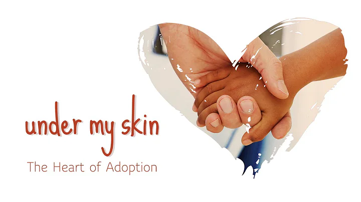 Under My Skin | Full Movie | Mark & Wanda Burchfie...