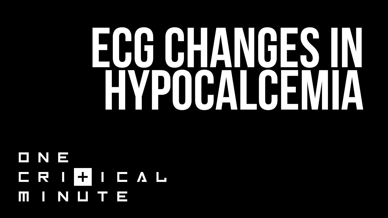 ECG changes in Hypocalcemia - One Critical Minute [1CM]