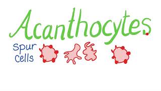 Acanthocytes (Spur Cells)
