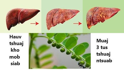 Hauv Tshuaj mob siab 3 tus tshuaj ntsuab sib tim zoo heev  - Tshuaj cawm seej TV