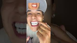 Si quieres dientes blancos usa esto! 🦷✨#dientesblancos #bodyaccel #parati #dientes #teethwhitening