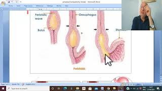 Esophageal disorders in Arabic 2 ( Achalasia of esophagus, part 1 ) , by Dr. Wahdan.