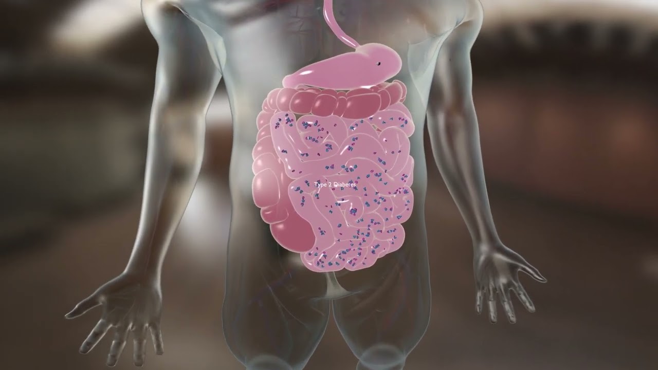 Diabetes:  The Physiological Role Of GLP1