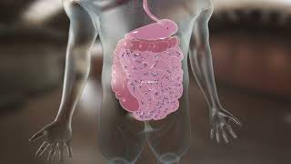 Diabetes:  The Physiological Role Of GLP1