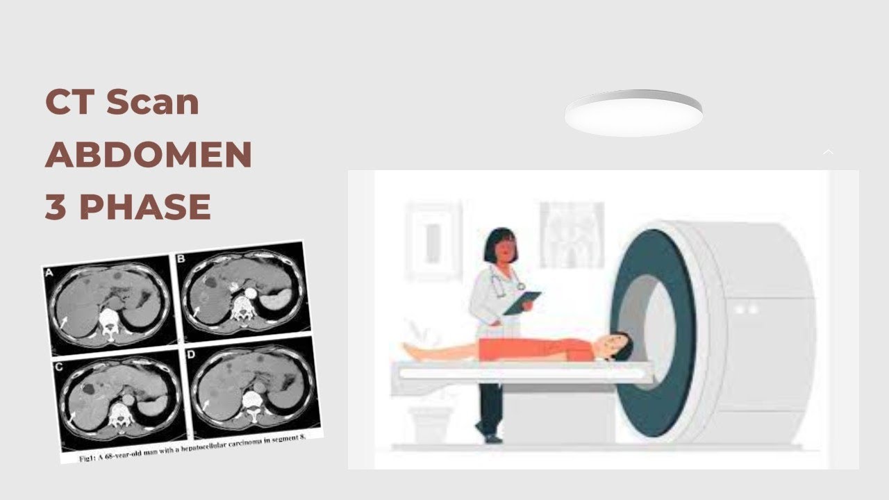 Teknik CT Abdomen 3 phase/Abdominal /kontras YouTube