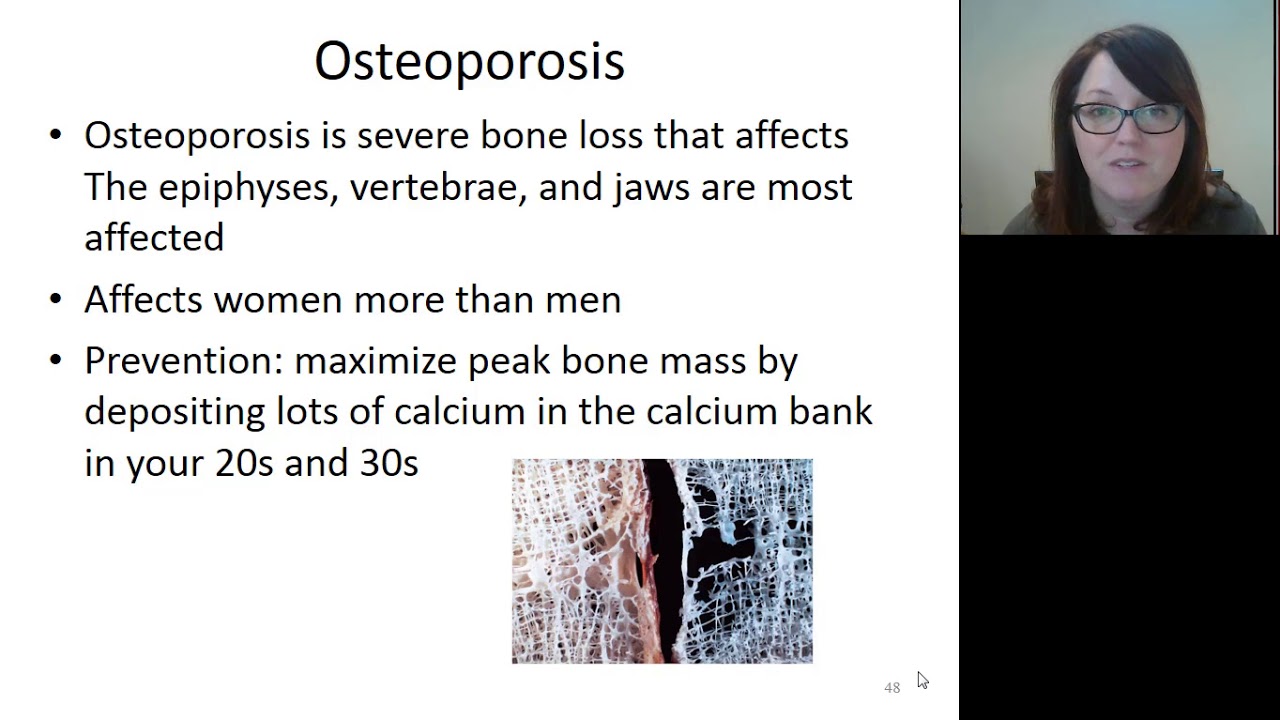 BIO 271 Bone hormones and bone disorders - YouTube