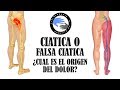 Ciatica o falsa ciatica, como diferenciar el sindrome del piramidal de una hernia