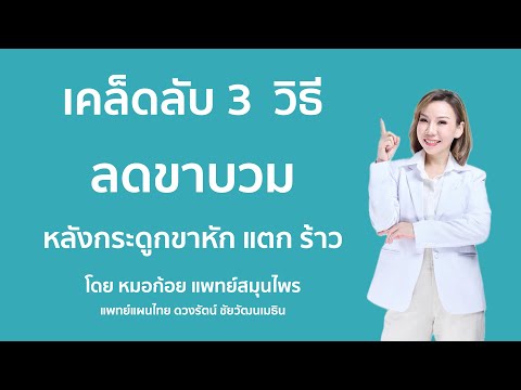 เคล็ดลับ 3  วิธีลดขาบวม หลังกระดูกขาหัก แตก ร้าว  กับ ดุสิตตา by เภสัชก้อย