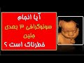 آیا آنجام سونوگرافی سه بعدی جنین خطرناک است آیا آنجام سونوگرافی سه بعدی جنین خطرناک است